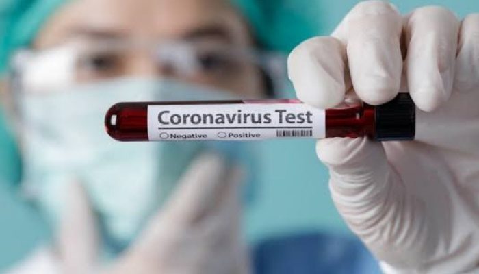 Kasus Penularan Bertambah, Lagi Dua Warga Bone Terpapar COVID-19